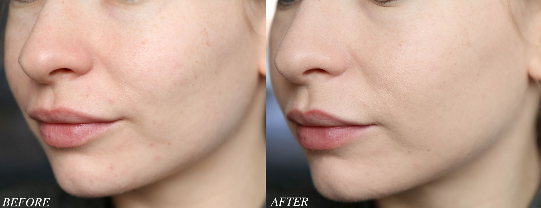 REVIEW Estee Lauder Double Wear Foundation Before & After Katie Snooks